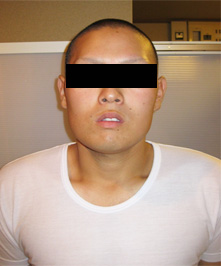 After